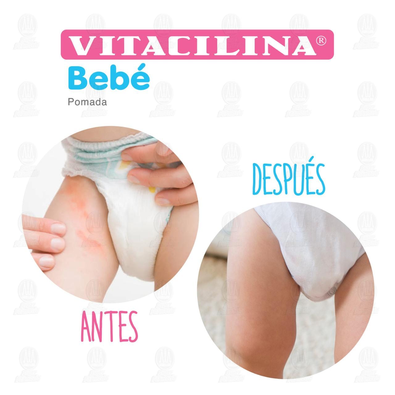 Vitacilina Beb&eacute; Pomada, 110 gr. image number 4