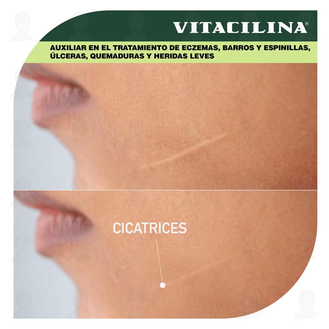 Vitacilina Ung&uuml;ento, 16 gr. image number 3