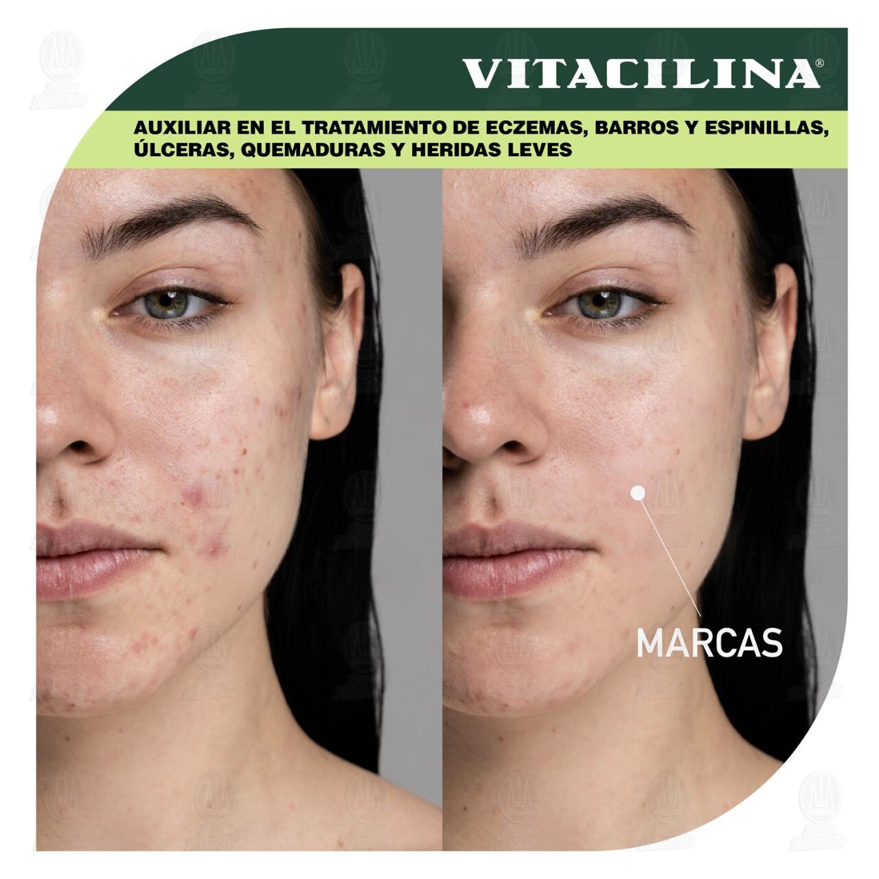 Vitacilina Ung&uuml;ento, 16 gr. image number 4